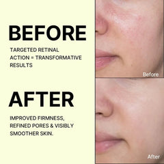 The Vita-A Retinal Shot Tightening Booster 15ML