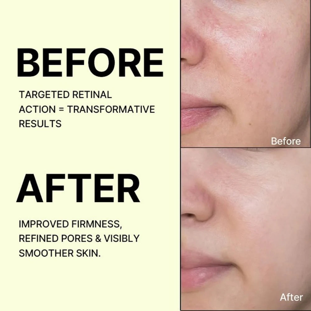 The Vita-A Retinal Shot Tightening Booster 15ML